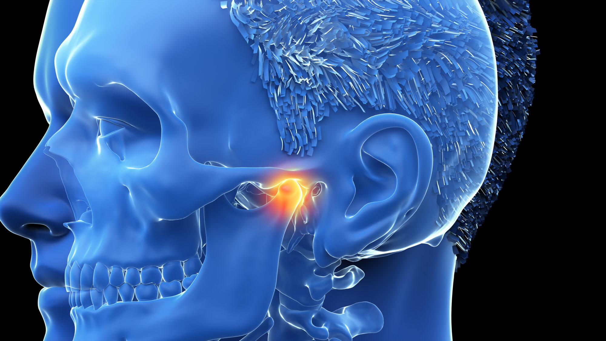 Temporomandibular Joint Dysfunction (TMJ): What Is It?